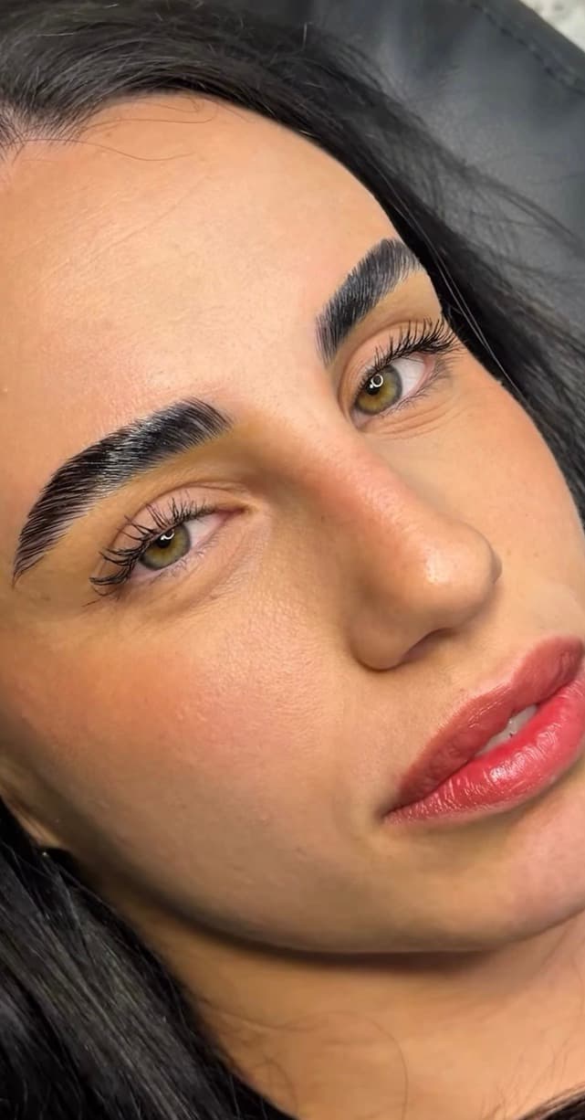 Nachher 3